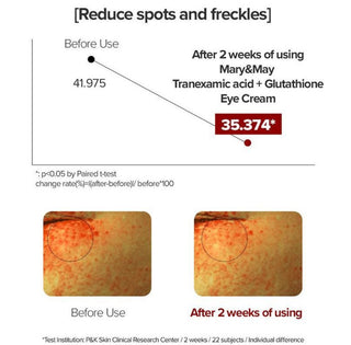 Mary&May Glutathione Eye Cream Special Set