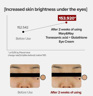 Mary&May Glutathione Eye Cream Special Set