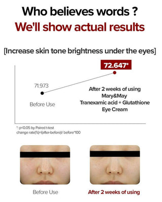 Mary&May Glutathione Eye Cream Special Set